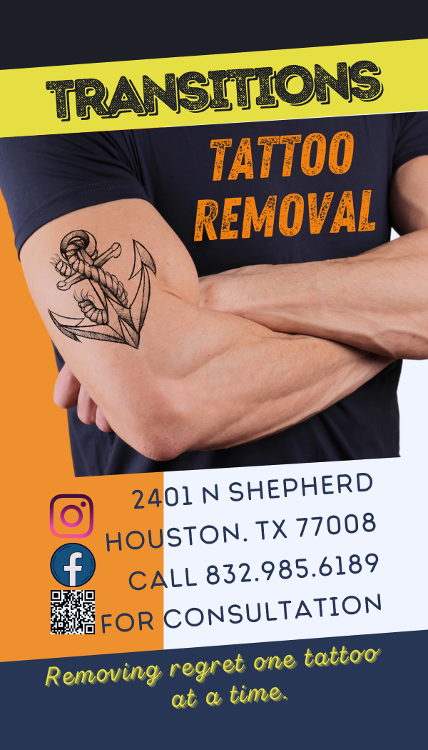 Tattoo removal in Houston  khoucom